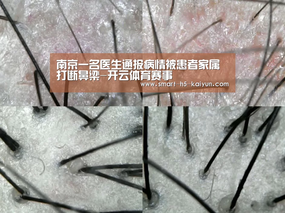 南京一名医生通报病情被患者家属打断鼻梁-